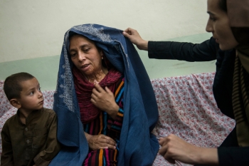 An Afghan woman pointing out burn scars in Pul-i-Kumri, Afghanistan