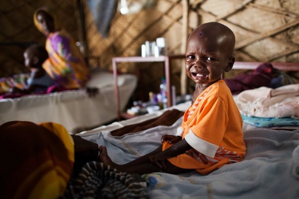 Bambino malnutrito in un campo nel Nord Darfur, settembre 2013.
