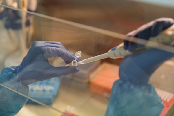 A scientist using a pipette with test tubes in a laboratory setting