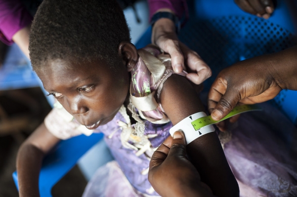 Kid who is doing the malnutrition test to understand its gravity