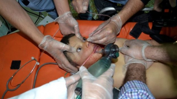 Un bambino &egrave; soccorso in seguito ad un attacco chimico