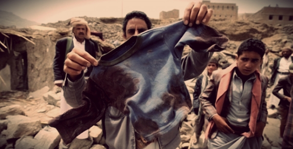 Un uomo mostra i vestiti di un bambino vittima della guerra 