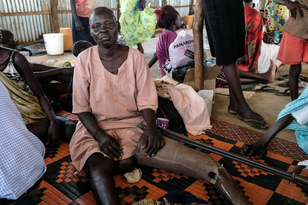 Una donna Shilluk costretta a fuggire da Malakal, Sud Sudan, dopo essere stata ferita nei combattimenti del 2014  