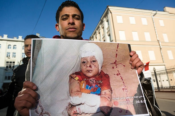 A Yemenite showing the image of a wounded Yemeni child