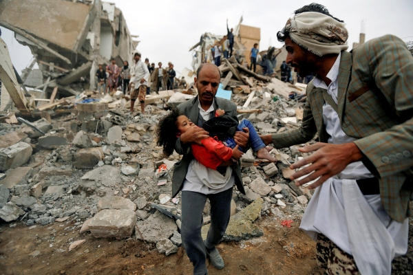 Un uomo trasporta una bambina ferita durante un attacco aereo da parte delle forze saudite a Sanaa, Yemen