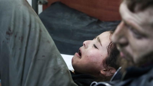 Una bambina siriana giace in un ospedale dopo incursioni aeree hanno preso di mira la sua città di residenza nella Ghouta orientale