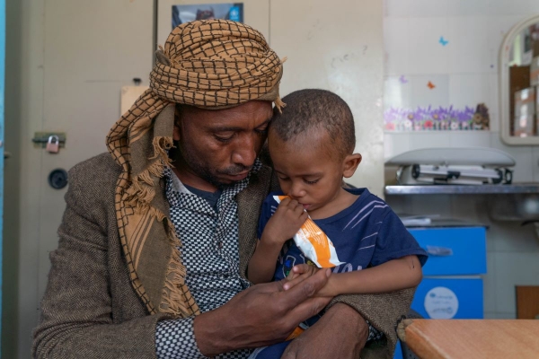 Yemen, in braccio al padre, Sultan, 21 mesi, riceve assistenza nutrizionale