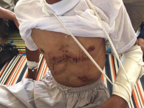 One of over 600 men and boys treated at Amiriyat al-Fallujah hospital.